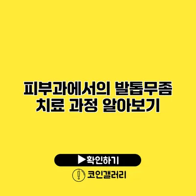 피부과에서의 발톱무좀 치료 과정 알아보기